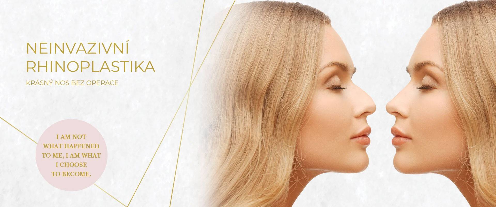 Neinvazivní rhinoplastika